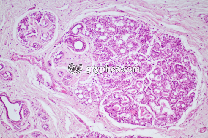 Glande mammaire active CT x40 - gryphea.com